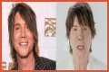 John Rzeznik Facelift | Goo Goo Dolls Frontman Plastic Surgery Before And After